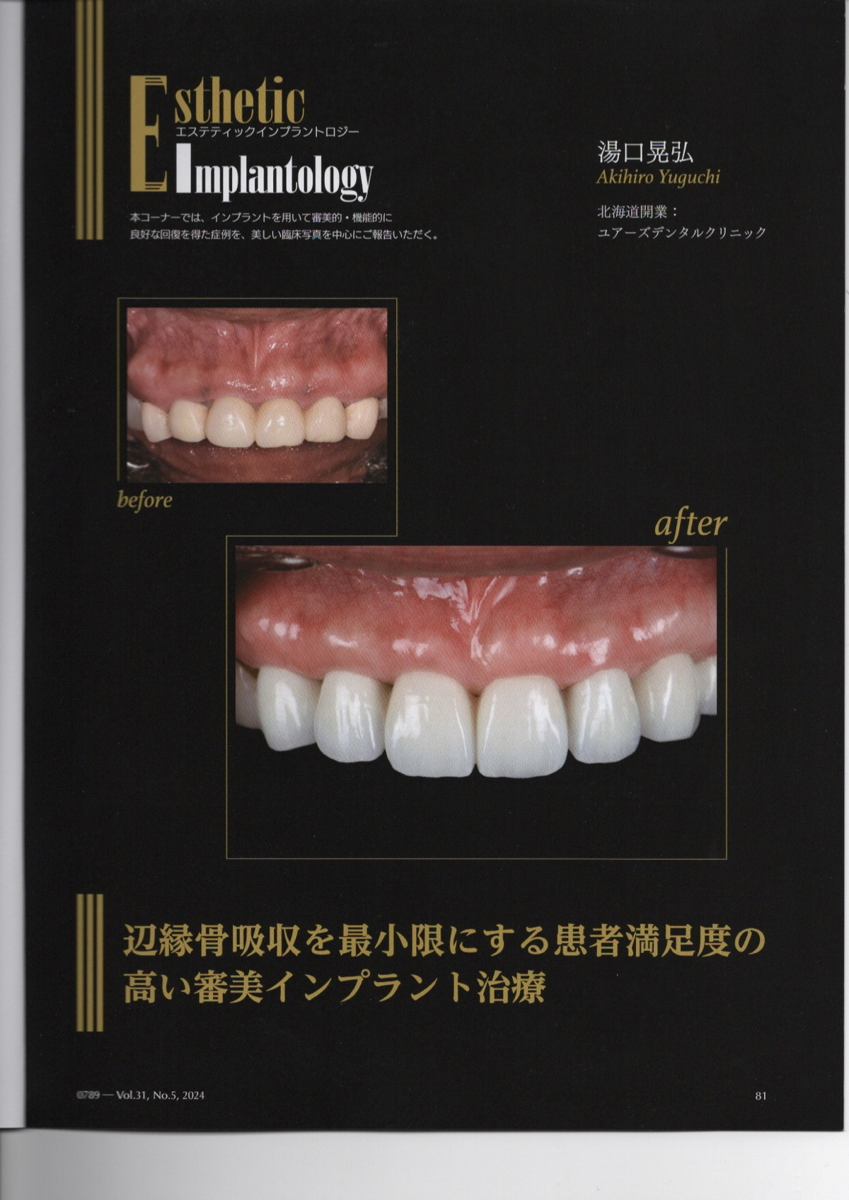 インプラント専門誌 Esthetic Implantology 症例報告掲載ページ