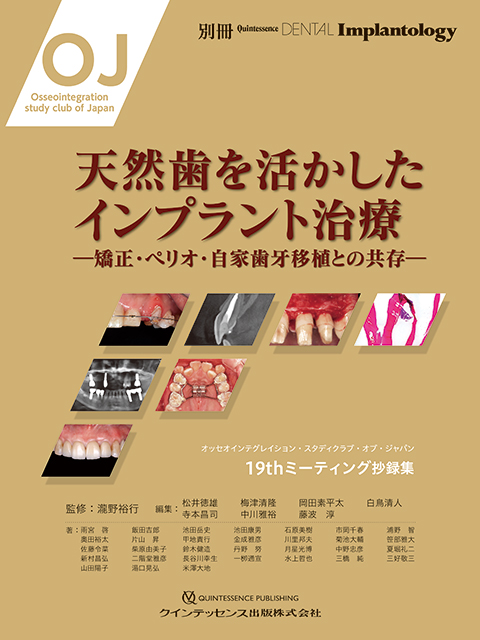 天然歯を活かしたインプラント治療