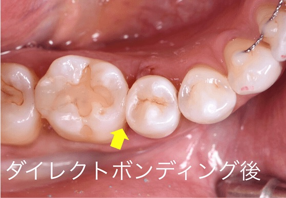 After