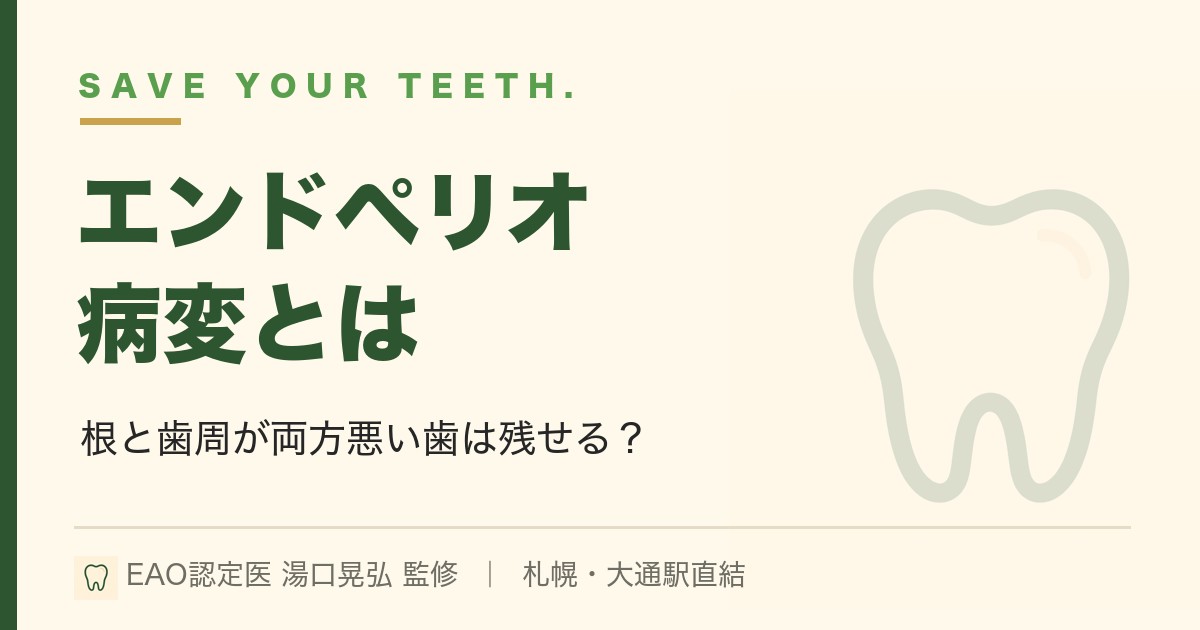 エンドペリオ病変とは｜歯周病と根の病気が重なった歯｜札幌・湯口晃弘